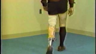 Gait deviations relating to a transtibial prosthesis [upl. by Vorster]