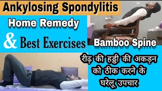 Ankylosing SpondylitisBamboo Spine Home remedies Best exercises and stretches In Hindi [upl. by Eilra]