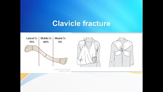 Clavicle Bone Demonstration  Anatomical Position  Attachments  Applied [upl. by Scever]