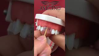 A good set of teeth fixed by modeal bead dentist Tips😘😘 🦷beadmisstoothrepairjxejxotooth [upl. by Onafets]