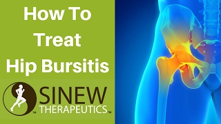 How To Treat Hip Bursitis and Speed Recovery [upl. by Venezia]