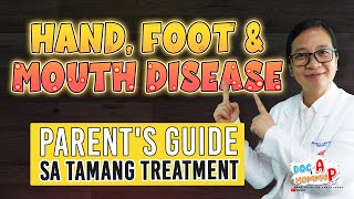 HAND FOOT and MOUTH DISEASE  Parents Guide sa Tamang Gamutan  Doc A Pediatrician [upl. by Laiceps664]