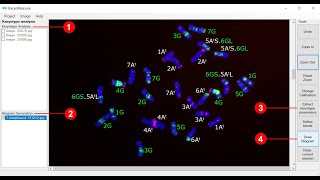 Karyotype analysis using KaryoMeasure [upl. by Nils]