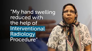 Swollen Hand Treatment Successful Thrombolysis and Oncology Treatment  Gleneagles Hospital [upl. by Enyleuqcaj]