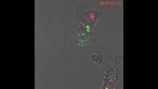 Natural Killer Cell kills cancerous B cell [upl. by Moreta]