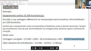 Prática de eritroblastos e reticulócitos [upl. by Notniv]