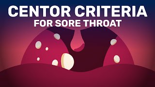 Is Your Sore Throat Caused by Bacterial Infection or Viral [upl. by Ainaznat]