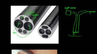 How Does an Endoscope Work  GCSE Physics [upl. by Gyimah460]