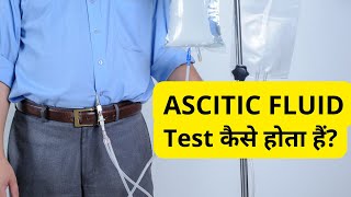 Ascitic Fluid Test in Hindi  Ascitic Fluid Analysis Procedure से क्या पता चलता हैं [upl. by Owades]