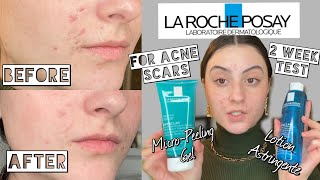 TESTING LA ROCHE POSAY EFFACLAR Lotion Astringent amp MicroPeeling Gel for ACNE SCARS [upl. by Flossy]