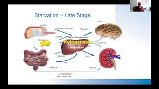 Nutrition Screening amp Assessment Specifically in Critically ill Patients [upl. by Ojillib]