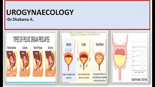 UROGYNAECOLOGY SESSION  CystocelePOPduring pregnancy amp UrodynamicsGraph Interpretation made easy [upl. by Aicyla]