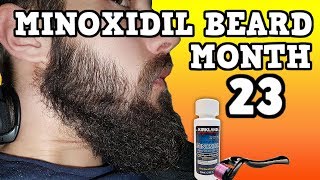 Minoxidil Beard Growth Results  Month 23  TheJourneyContinues [upl. by Aletha]