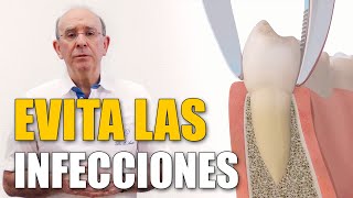 🤔 EXTRACCIÓN dental cuándo es necesaria y CUIDADOS posteriores [upl. by Tia]