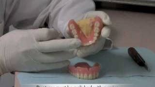 How to perform Denture Repairs  Huntington Beach and Corona [upl. by Ahsinahs]