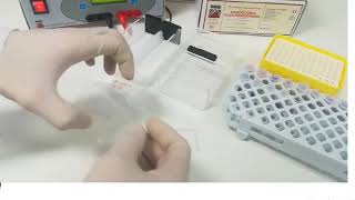 Hemoglobin electrophoresis procedure [upl. by Annirac]