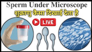 semen analysis test in hindi  Semen Test  Semen Test Report  Sperm Countsemenanalysistest semen [upl. by Nomal]