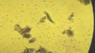 what kind of Paramecium is this [upl. by Nnail732]