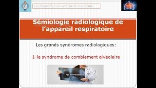 le syndrome de comblement alvéolaire sémiologie radiologie lesgrandssyndromesradiologique [upl. by Adnuhsat]