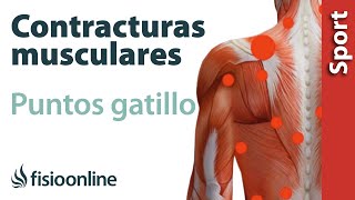 3 cosas que debes saber sobre las contracturas musculares y los puntos gatillo [upl. by Annaeirb]