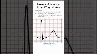 Causes of acquired long QT syndrome [upl. by Kerstin945]