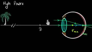 Myopia amp Hypermetropia Hindi  Human eye and the colourful world  Physics  Khan Academy [upl. by Asyar847]