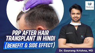 ⭐PRP PlateletRichPlasma After Hair Transplant in Hindi  PRP Benefit amp Side Effect [upl. by Vick]