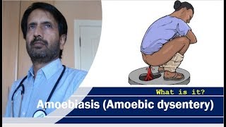 Amoebiasis Amoebic dysentery  Treatment complications and prevention of dysentery [upl. by Nnalyrehc399]