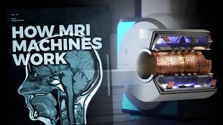 The Insane Engineering of MRI Machines [upl. by Graves891]