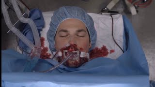 DeLuca Dies  Greys Anatomy Season 17 Episode 7 [upl. by Lafleur800]