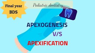 APEXOGENESIS vs APEXIFICATION Pediatric Dentistry Final year BDS Dental [upl. by Lledroc]