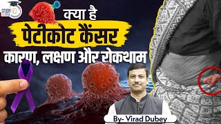 What Is Petticoat Cancer Causes Symptoms And Prevention  By Virad Dubey  Study IQ IAS Hindi [upl. by Brockie]