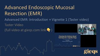 Advanced EMR Introduction  Vignette 1 Taster video [upl. by Hallie]