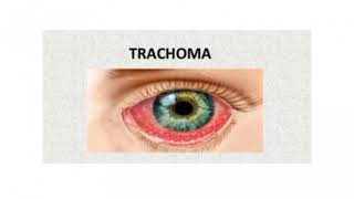 TRACHOMA Introduction of trachoma  Definition of trachoma Causes of trachoma✨ [upl. by Zetnod150]