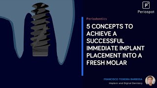 Mastering Immediate Molar Implants 5 Key Concepts for Success [upl. by Adiarf]