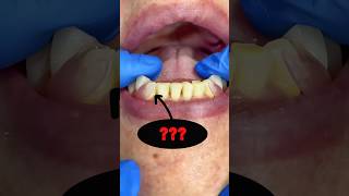 DID YOU KNOW that flexible dental prostheses exist music amongus beats animation art mrdent [upl. by Mosley932]