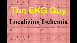 EKGECG Localizing Myocardial Ischemia  Question 180  The EKG Guy [upl. by Ardle91]