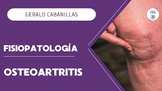 FISIOPATOLOGÍA  OSTEOARTRITIS [upl. by Ynnatirb477]