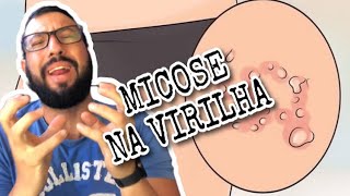 TUDO SOBRE MICOSE DE VIRILHA E COMO SE LIVRAR DELA Me LEANDRO MOSCARDI [upl. by Salangi556]