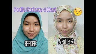 Review Whitening Series Egyptian Beauty Skin Memutihkan Kulit Dengan Cepat  Cikal Ananda [upl. by Body]