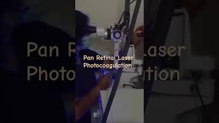 Retinal laser for diabetic retinopathy Panretinal Laser Photocoagulation retinalaser [upl. by Akcimehs]