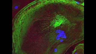 TNFalpha Activated Macrophages [upl. by Theodore]