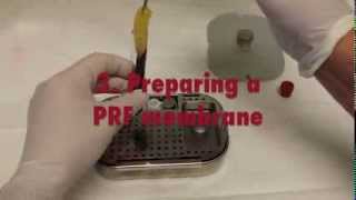 Platelet Rich Fibrin PRF  A short introductory Video [upl. by Amberly]