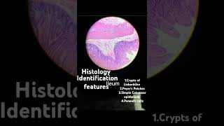 ANATOMY  HISTOLOGY  ILEUM  IDENTIFICATION FEATURES mbbs science medstudent medstudent you [upl. by Glialentn]