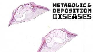 Metabolism amp Deposition Diseases in Skin dermatology dermpath pathology board review [upl. by Airamahs]