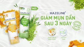 Hazeline  Giảm mụn dần sau 3 ngày  Dòng sản phẩm cho da dầu mụn và da nhạy cảm [upl. by Fidele]