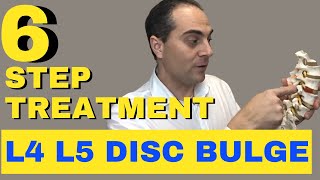 6 Step L4 L5 Disc Bulge Treatment L4 L5 Bulging Disc Treatment by Dr Walter Salubro [upl. by Annnora]