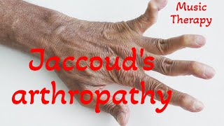 Jaccouds arthropathy  Music Therapy [upl. by Telrahc308]