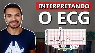 ONDAS DO ECG Cardio 06 [upl. by Row]