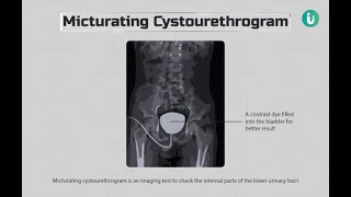 Anterograde Urethrography Xray  Micturating CystoUrethrogram Xray [upl. by Wehhtam]